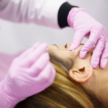 Fios de PDO em Petrópolis