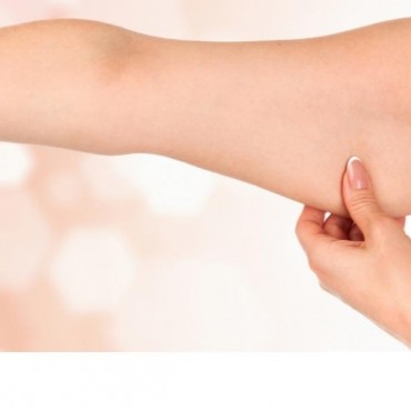 Tratamentos para Flacidez em Petrópolis